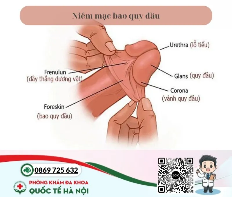 Niêm mạc bao quy đầu