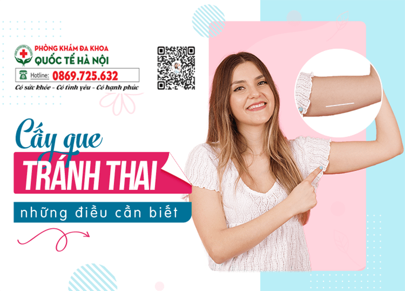 cấy qua tránh thai tại hà nội bao nhiêu tiền