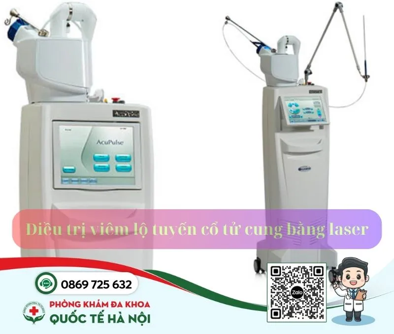 Điều trị viêm lộ tuyến cổ tử cung bằng laser