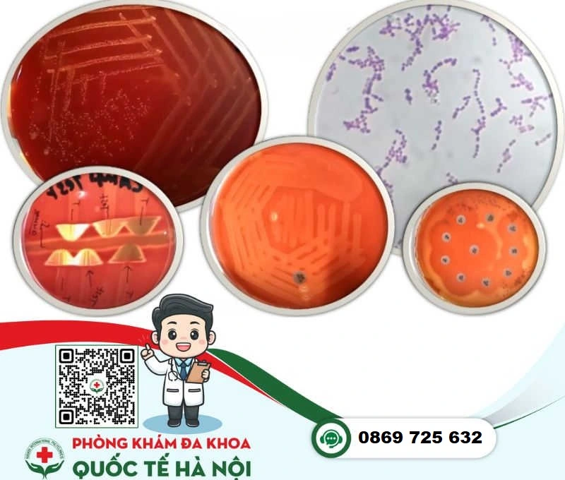 Bệnh phụ khoa streptococcus