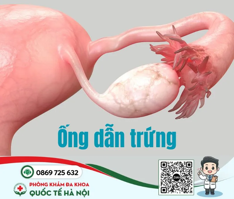 Ống dẫn trứng trông như thế nào?