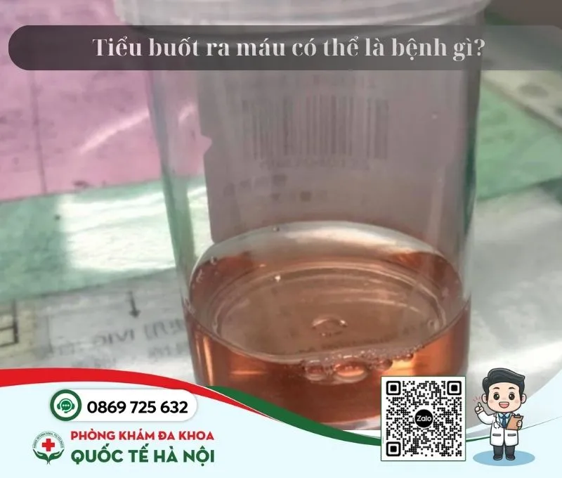 Tiểu buốt ra máu có phải dấu hiệu mang thai không? 3