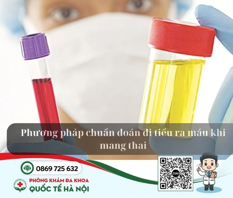 Tiểu buốt ra máu có phải dấu hiệu mang thai không? 4