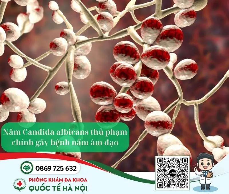 nấm âm đạo Candida albicans