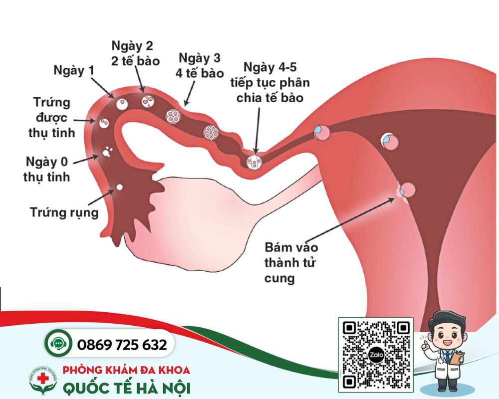 Phôi thai bám vào tử cung