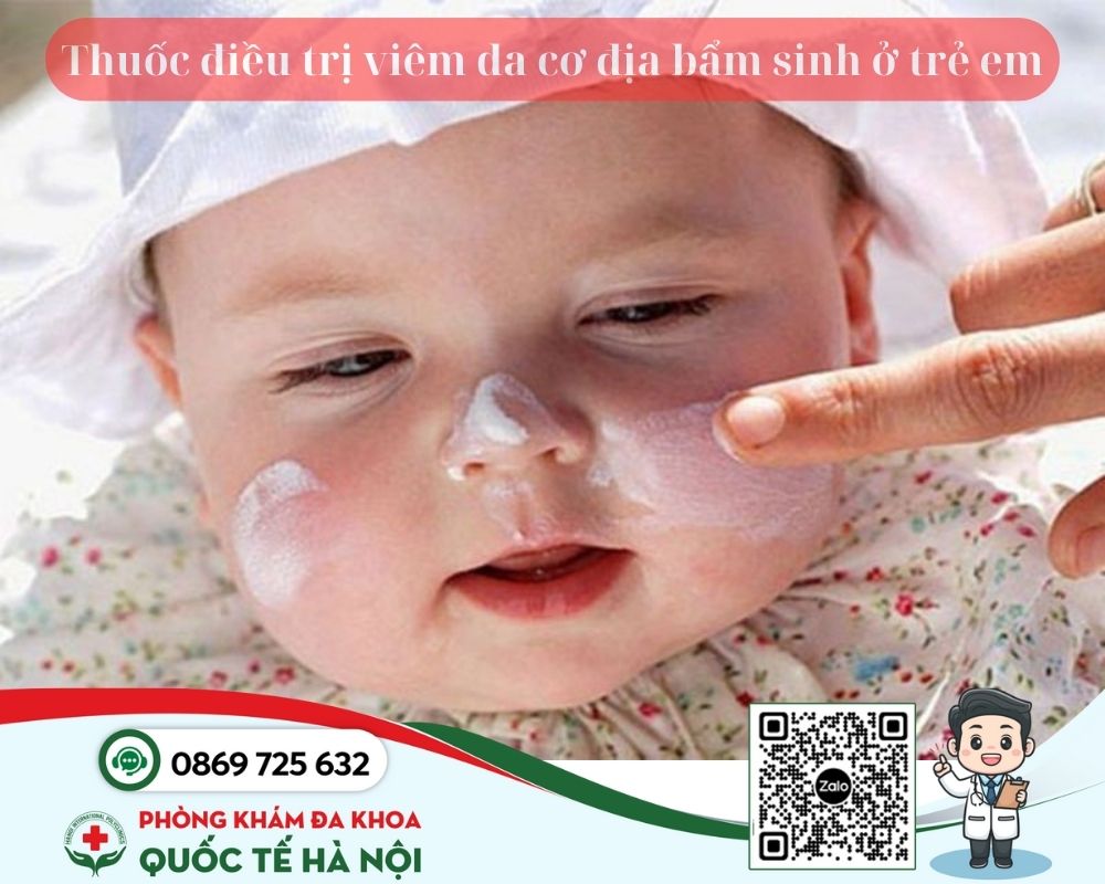 Viêm da cơ địa bẩm sinh ở trẻ em dùng thuốc gì