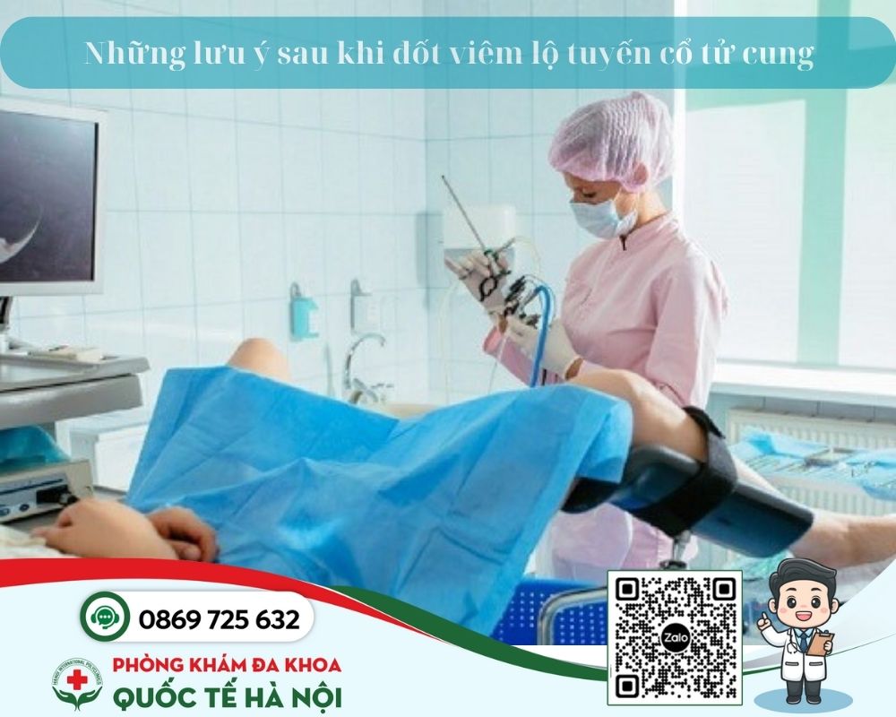 Những lưu ý sau khi đốt viêm lộ tuyến cổ tử cung