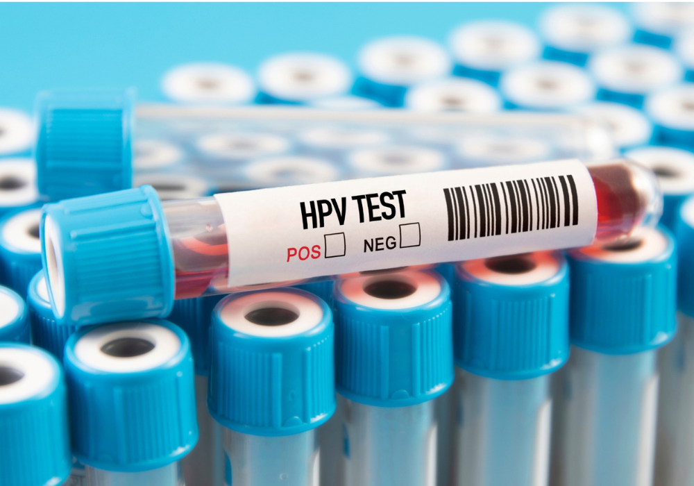 xét nghiệp hpv tầm soát ung thư cổ tử cung