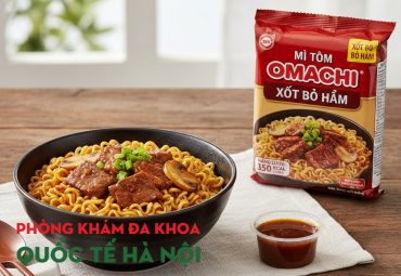 mi-tom-omachi-xot-bo-ham-bao-nhieu-calo