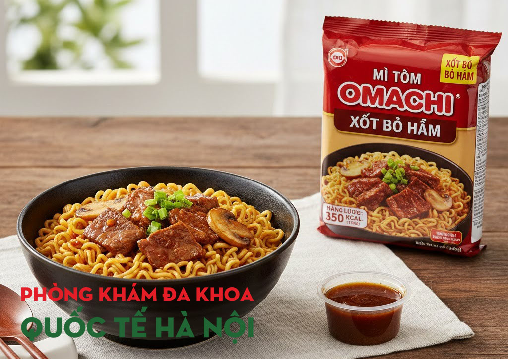 Mì tôm omachi xốt bò hầm bao nhiêu calo và ăn có béo không? 1 Mì tôm omachi xốt bò hầm bao nhiêu calo và ăn có béo không?